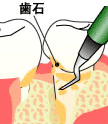 流れ